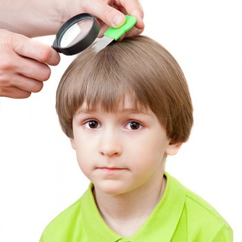 cabello-antiparasitos