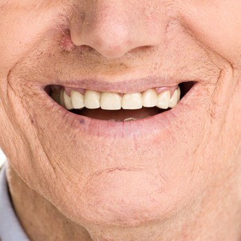 higiene-protesis-dentales